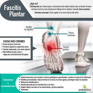 fascitis-plantar-inflamacion